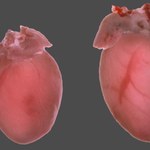 Naukowcy wiedzą jak przeciwdziałać zawałom serca