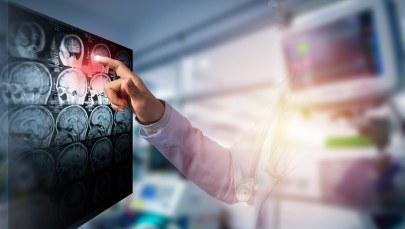 Naukowcy wydrukowali tkankę ludzkiego mózgu