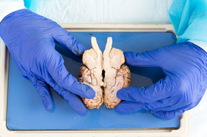 Naukowcy wyhodowali mózg 5-tygodniowego płodu
