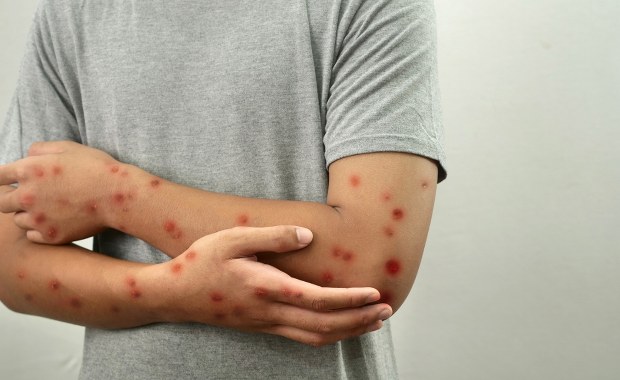 Naukowcy wykryli nową odmianę wirusa. U osoby, która wróciła z Azji