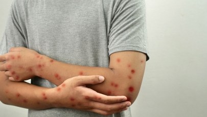 Naukowcy wykryli nową odmianę wirusa. U osoby, która wróciła z Azji