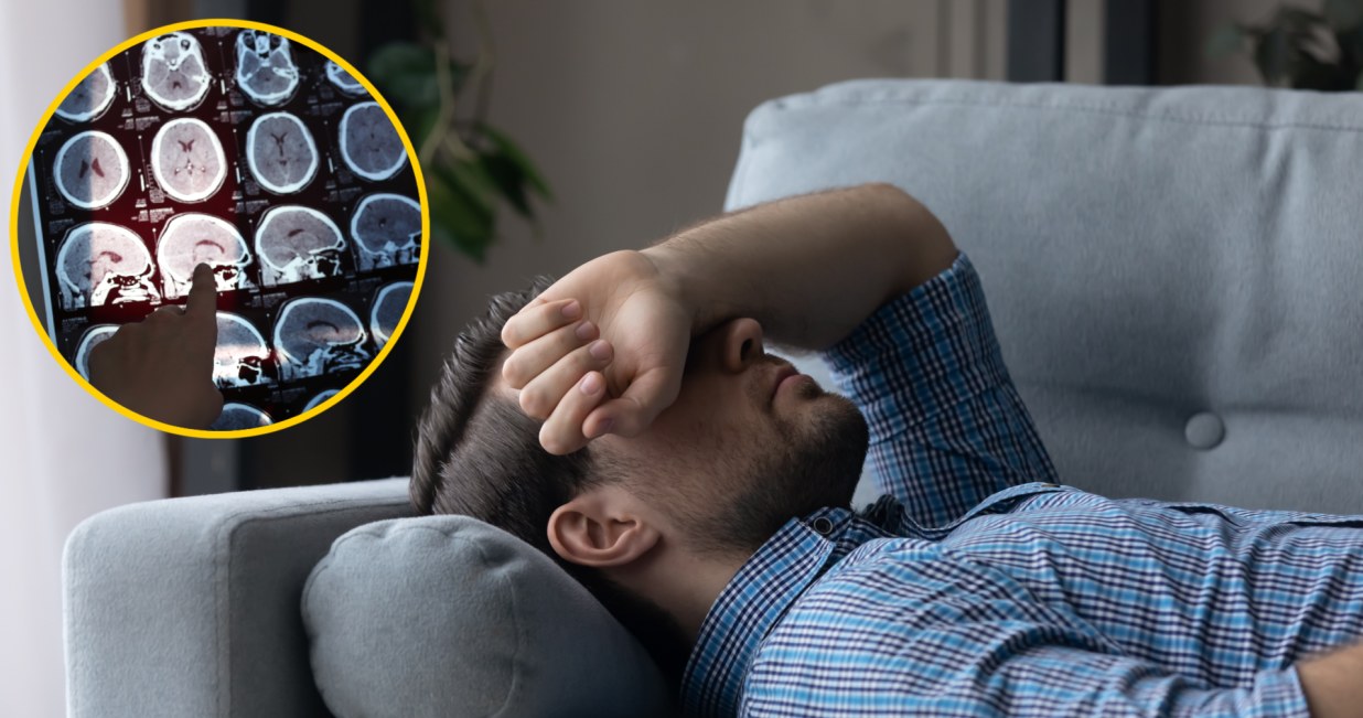 Naukowcy znaleźli powiązanie między migrenami a zmianami w mózgu /123RF/PICSEL