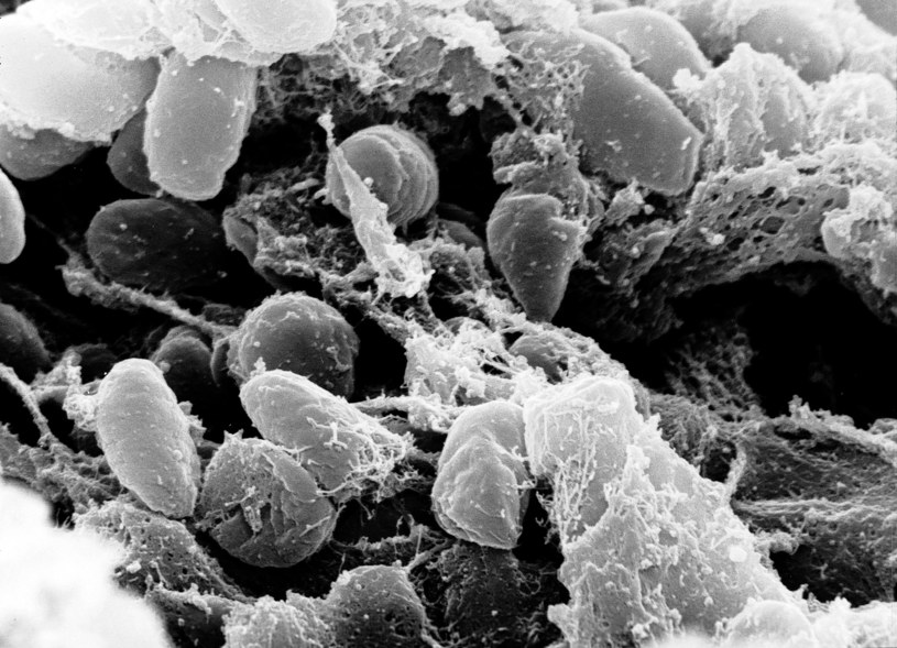 Naukowcy znaleźli w badanych próbkach bakterię dżumy, Yersinia pestis /Domena publiczna /Wikimedia