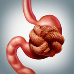 Nerwica żołądka: Przyczyny, objawy i leczenie