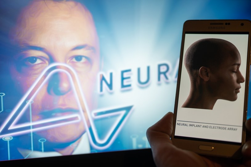 Neuralink Elona Muska wkrótce zacznie wszczepiać mózgowe implanty ludziom /JONATHAN RAA / NurPhoto /AFP