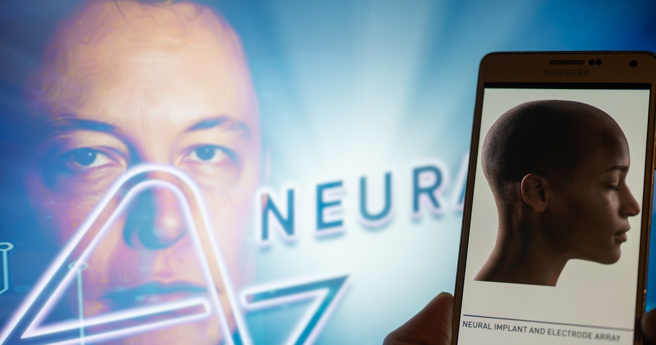 Neuralink Elona Muska wkrótce zacznie wszczepiać mózgowe implanty ludziom /JONATHAN RAA / NurPhoto /AFP