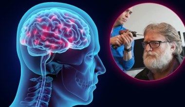 Neuralink ma rywala. Pierwszy chip mózgowy Starfish w tym roku