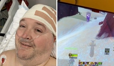 Neuralink: pacjenci z ALS odzyskują mowę i grają w gry