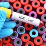 Neuroblastoma - najczęstszy nowotwór niemowląt