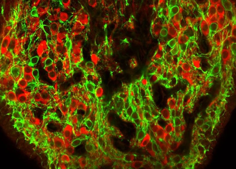 Neurony regulujące pragnienie - CAMKII (czerwone) i VGAT (zielone) /materiały prasowe