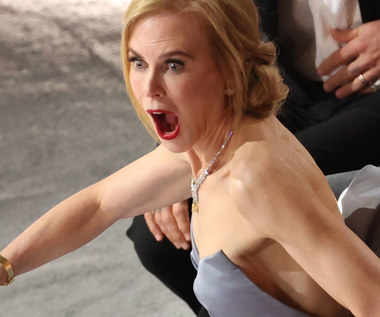 Nicole Kidman: Co się stało z twarzą hollywoodzkiej aktorki?