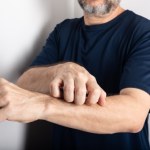 Nie drap się. Serio...