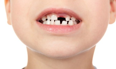 Nie lekceważ mleczaków. „Przedwczesna utrata zębów prowadzi do przykrych konsekwencji”