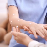 Nie trzeba wirusa. Odporność reaguje na sam widok chorego