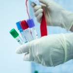 wysoki cholesterol Nie tylko cholesterol LDL. Lipoproteina(a) - co należy o niej wiedzieć?