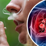Nie tylko palenie papierosów. Te czynniki zwiększają ryzyko raka płuc