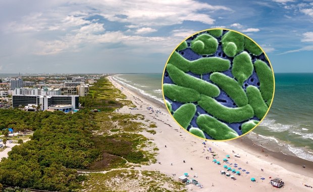 Nie żyją cztery osoby. Groźna bakteria "zjada ciało" i sieje postrach