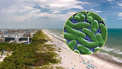 Nie żyją cztery osoby. Groźna bakteria "zjada ciało" i sieje postrach