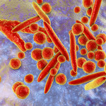 Niebezpieczna lekooporna bakteria rozprzestrzenia się w USA