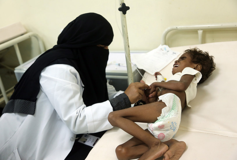 Niedożywione dziecko w jednym z jemeńskich szpitali /Abdo HYDER /AFP