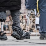 Niemieckie firmy zwiększają dostawy do Rosji. Chodzi o… protezy