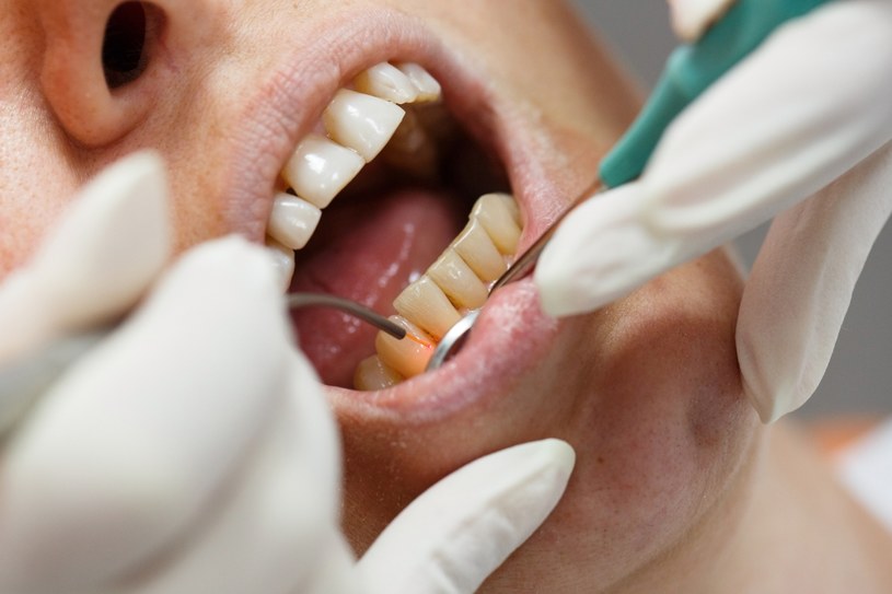 Niepokojące zmiany w jamie ustnej warto skonsultować z dentystą /123RF/PICSEL