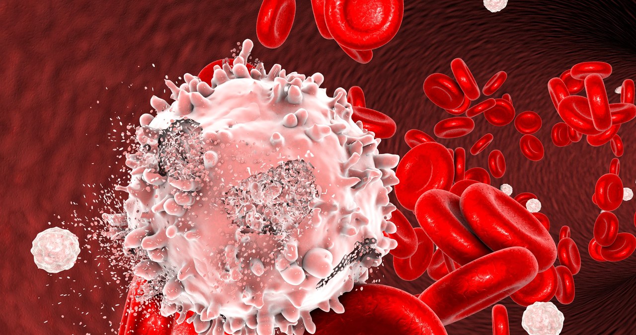 Nieprawidłowe komórki gromadzą się w szpiku kostnym oraz krwi obwodowej, rozrastając się i naciekając na inne tkanki i narządy wewnętrzne /123RF/PICSEL