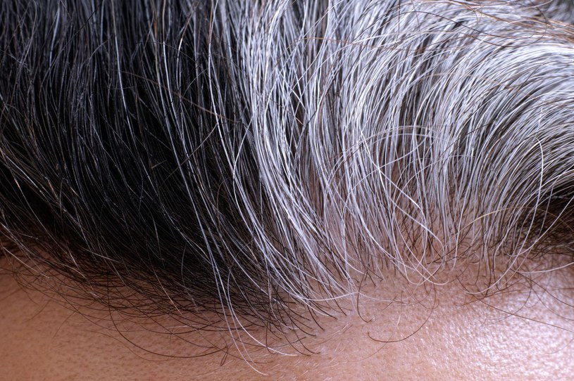 Niewłaściwa pielęgnacja i produkty do włosów z substancjami chemicznymi mogą sprawić, że zaczną one szybciej siwieć /123RF/PICSEL