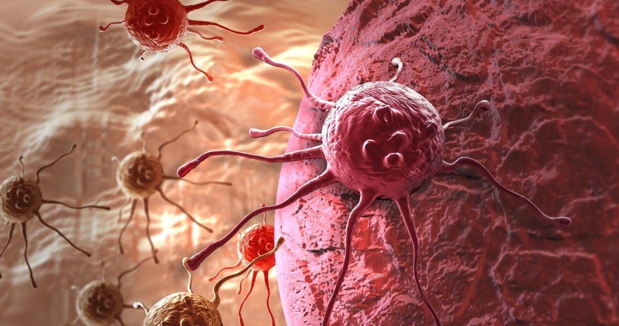 Nowa metoda walki z rakiem zmieni komórki nowotworowe w tłuszczowe /Geekweek