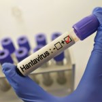 Nowe fakty ws. naszego obywatela, który miał kontakt z hantawirusem