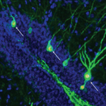 Nowe neurony do walki z Alzheimerem