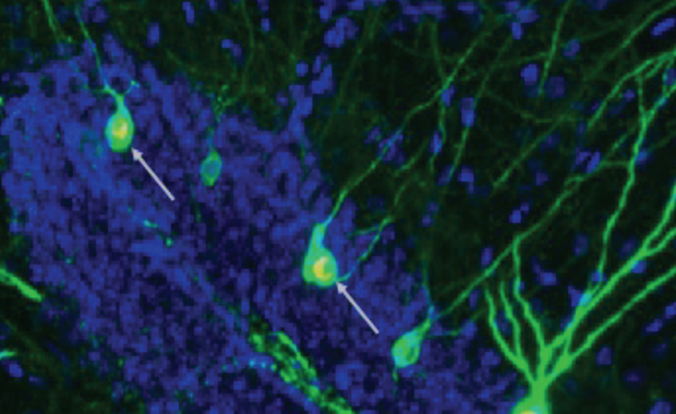 Nowe neurony do walki z Alzheimerem