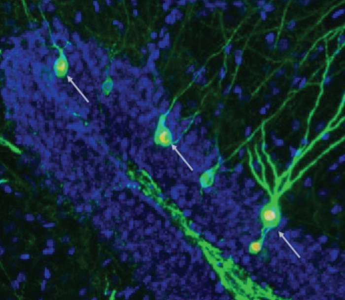 Nowe neurony (zaznaczone strzałkami) w hipokampie, biorące udział w procesach zapamiętywania /© 2022 Mishra et al. Originally published in "JEM". https://doi.org/10.1084/jem.20220391 /Materiały prasowe