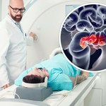 Nowe odkrycie medyczne. Przyszłość leczenia nowotworów