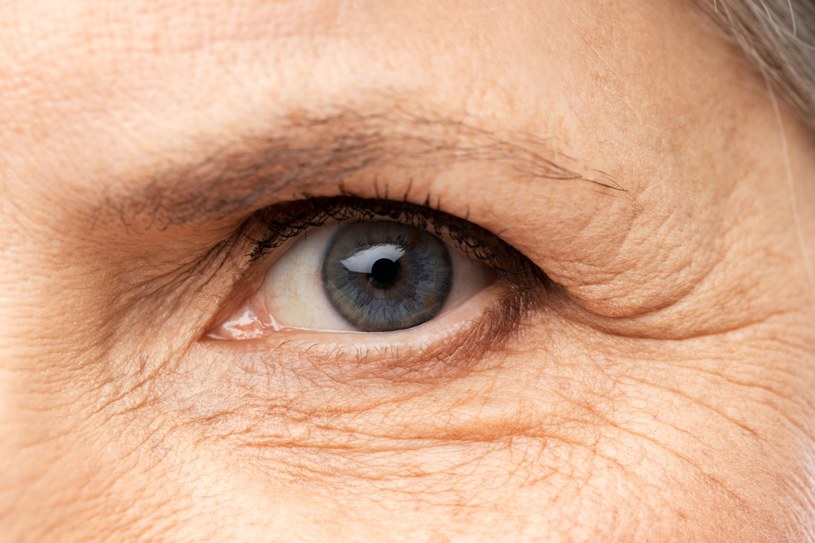 Nowe odkrycie naukowe dowiodło, że alzheimera można wykryć w oczach /123RF/PICSEL