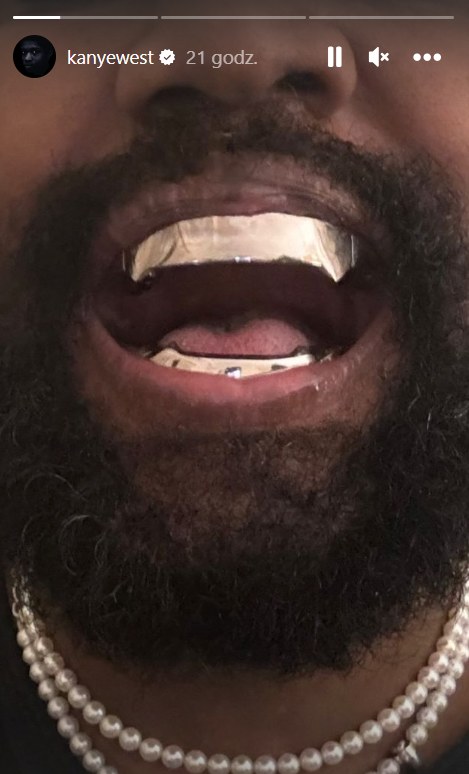 Nowe zęby Kanyego Westa /instagram.com/kanyewest /materiał zewnętrzny