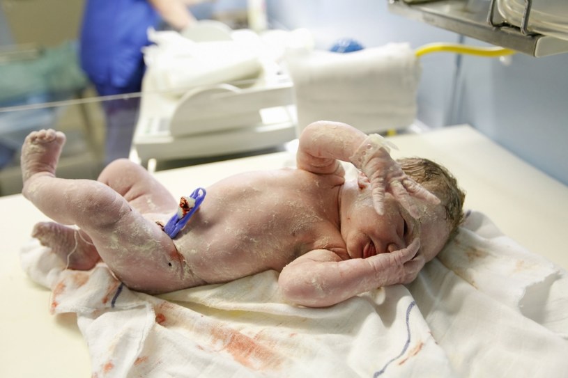 Nowo narodzone dziecko nie przypomina różowego bobasa z reklamy /123RF/PICSEL