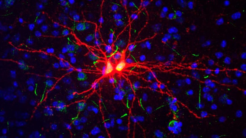 Nowo powstałe neurony w ciele migdałowatym /materiały prasowe