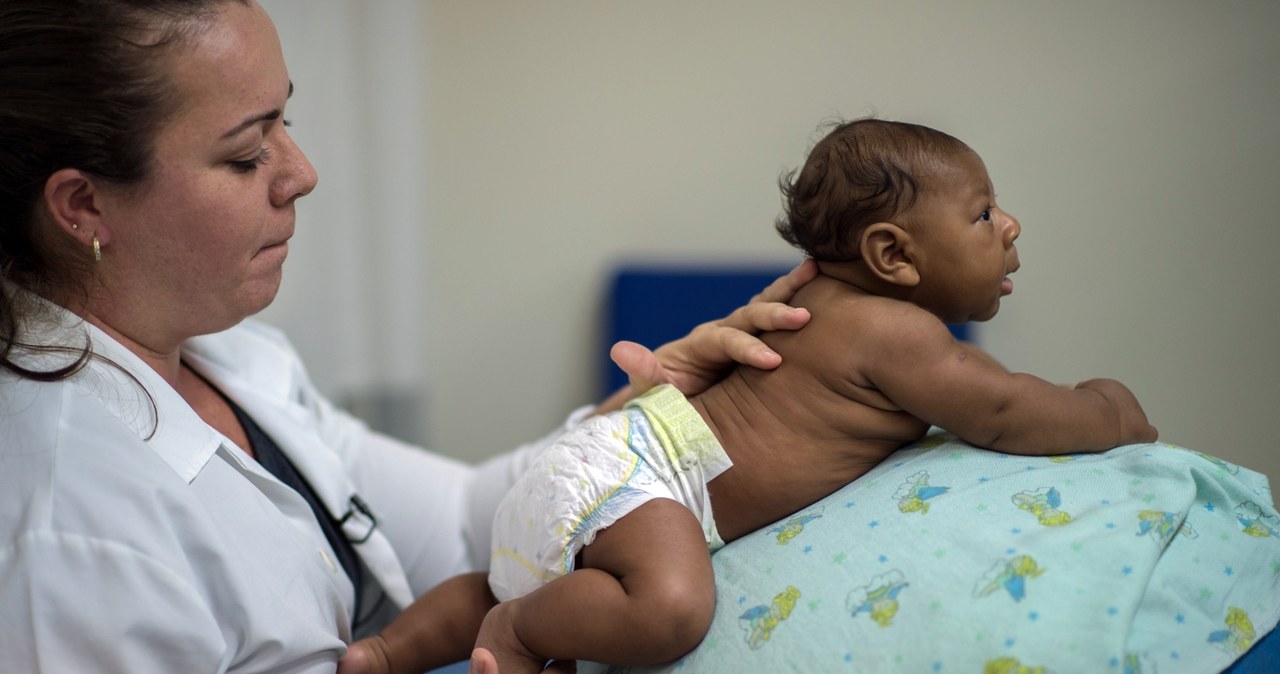 Noworodek cierpiący na mikrocefalię, przypadłość wywołaną wirusem Zika /AFP