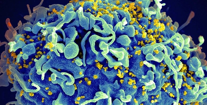 Nowy cel szczepionek przeciwko wirusowi HIV /materiały prasowe