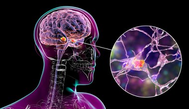 Nowy lek hamuje Alzheimera. Bohaterski pilot z rzeki Hudson też z nim walczy