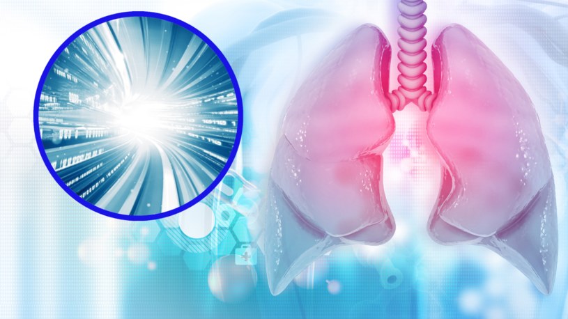 Nowy model AI może pomóc w leczeniu raka płuc /123RF/PICSEL