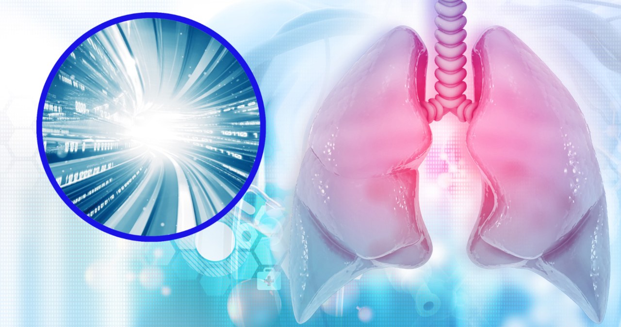 Nowy model AI może pomóc w leczeniu raka płuc /123RF/PICSEL