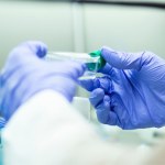 Nowy przypadek groźnego pasożyta u człowieka