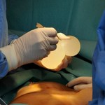 Nowy skandal z francuskimi implantami piersi