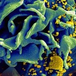 Nowy sposób detekcji wirusa HIV