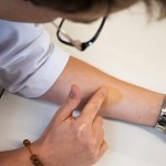 Nowy sposób walki z trądzikiem? Naukowiec z Polski rozwija projekt