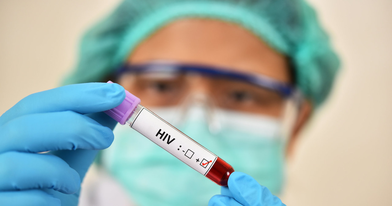 Nowy sposób walki z wirusem HIV /123RF/PICSEL