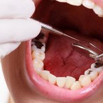 NRL: Koniec z czarnymi plombami u dentysty