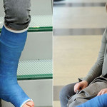 "O mnie się nie martw": Joanna Kulig gra z unieruchomioną nogą! Mamy zdjęcia!